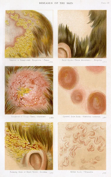Diseases of the Skin - Plate 4