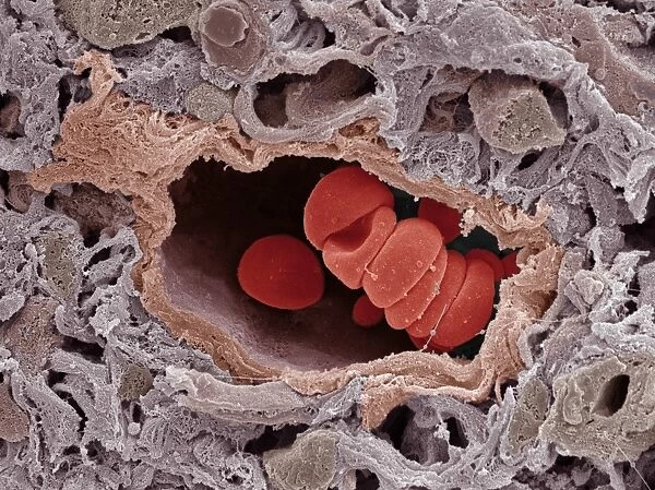 Arteriole and red blood cells, SEM