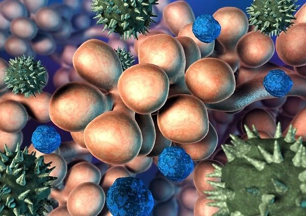 Asthma. Computer artwork of allergens (blue and green) amongst alveoli 