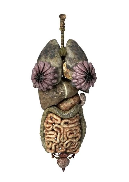 3D rendering of unhealthy female internal organs