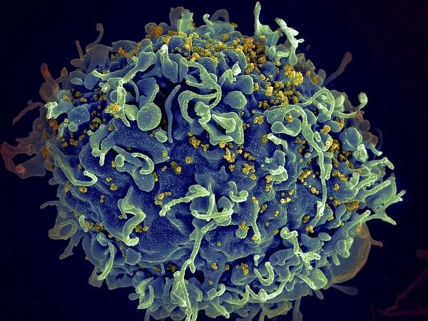 Scanning electron micrograph of HIV particles infecting a human H9 T cell