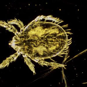 Dark Field Light Micrograph: Scrub Typhus Mite Chigger - Magnification x 125 (if print A4 size: 29. 7 cm wide)