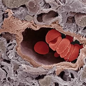 Arteriole and red blood cells, SEM