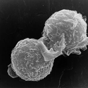 SEM of two polymorphonuclear white blood cells