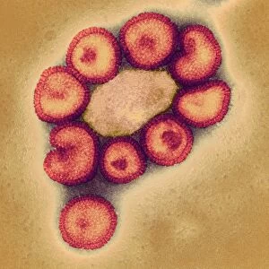 Swine flu virus particles, TEM C016 / 9407