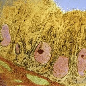 Uterus cells, TEM