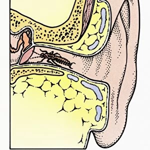 Cross section illustration of Common Earwig (Forficula auricularia) in auditory canal of ear, touching tympanic membrane with antennae