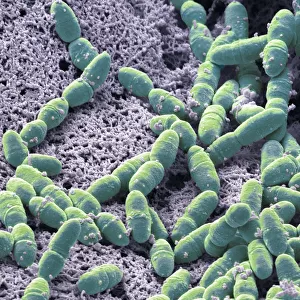 Streptococcus mutans, SEM