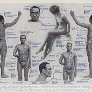 Aches and Pains, Diagrams indicating the Parts of the Human Body where Natures Warnings are First Experiened (b / w photo)