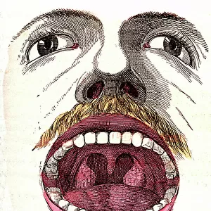 The mouth and teeth - Normal life & health by J. Rengade. Drawing A. Demarle 1881