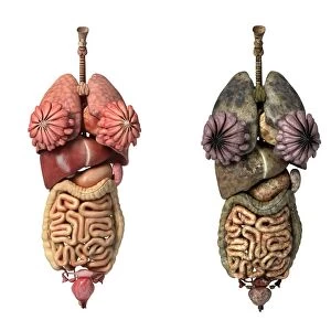 Comparison of healthy and unhealthy female organs