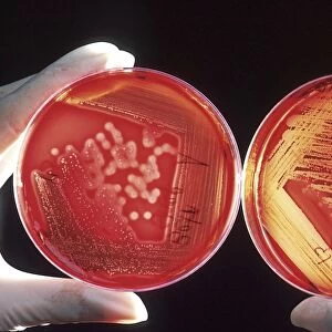 Red blood cells on an agar plate are used to diagnose infection