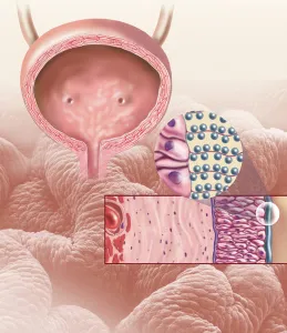 Detail of the cellular structure that forms the bladder lining
