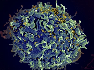 Scanning electron micrograph of HIV particles infecting a human H9 T cell Scanning electron micrograph of HIV particles infecting a human H9 T cell